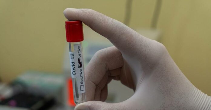 blood test in solihull